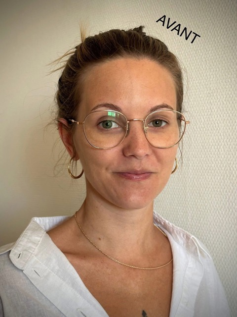 Avant relooking visage